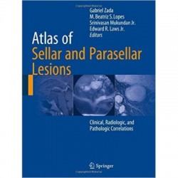 Atlas of Sellar and Parasellar Lesions 1st/2016